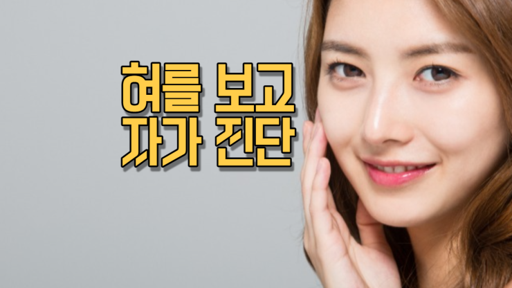  혀를 보고 자가 진단
