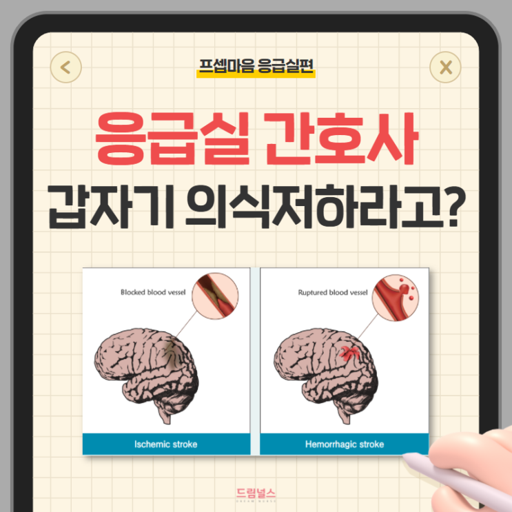 cerebral infarction 뇌경색 응급실 신규간호사가 알아야 할 포인트 cerebral infarction 뇌경색 응급실 신규간호사가 알아야 할 포인트