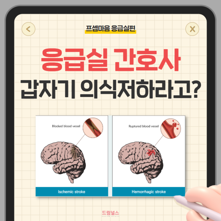 cerebral infarction 뇌경색 응급실 신규간호사가 알아야 할 포인트