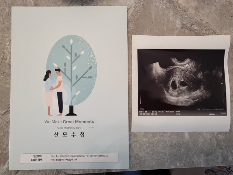  [시험관1차성공]쌍둥이 확정....^-ㅠ