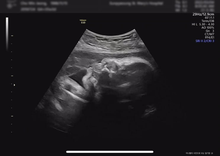 [임신 35주] 막달 첫 번째 진료 : 은평성모병원 산부인과