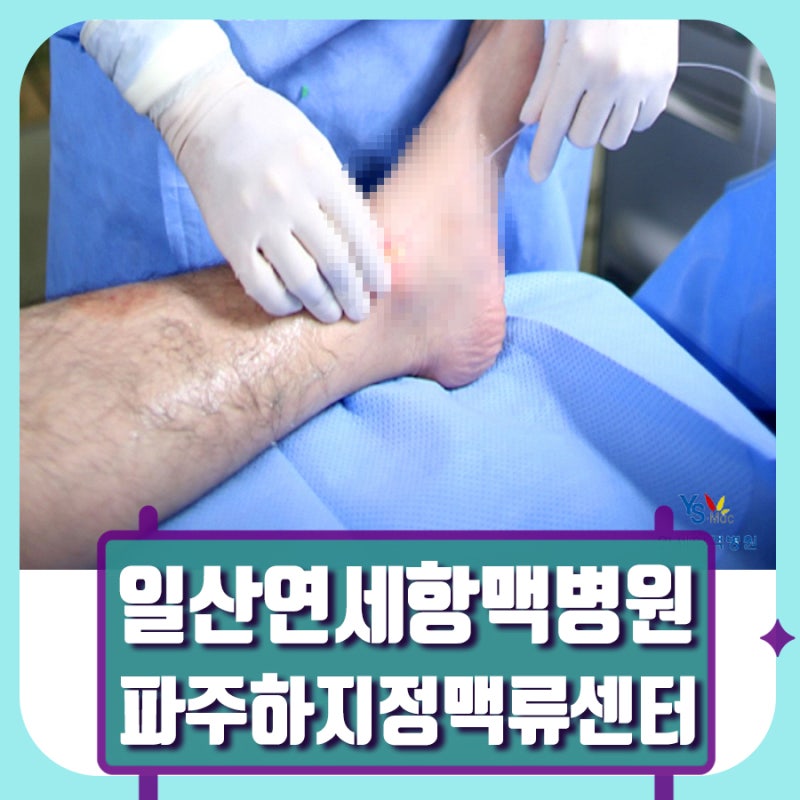 일산 하지정맥류 증상 판단 어려운 이유 연세항맥병원