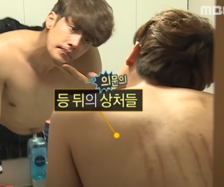 나혼자산다 성훈 키스마크, 하차 진실 나혼자산다 성훈 키스마크, 하차 진실