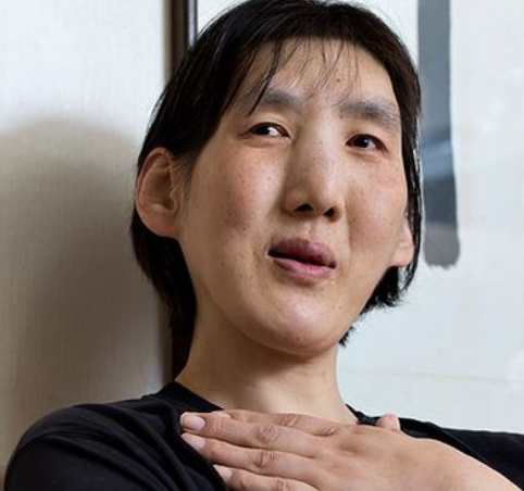 김영희 농구선수 병, 프로필, 가족, 근황 김영희 농구선수 병, 프로필, 가족, 근황