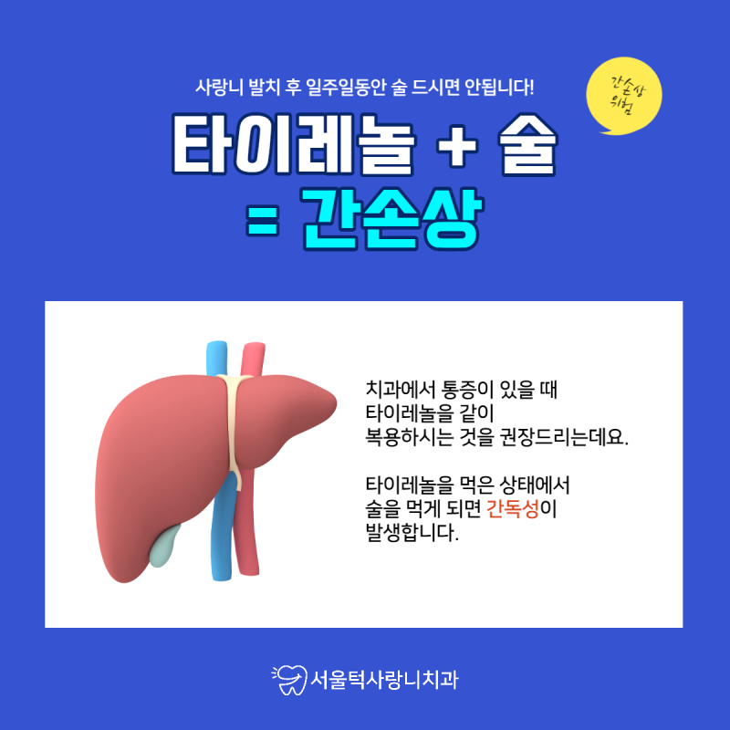사랑니 발치 후 음주 가능 vs 안돼! 3