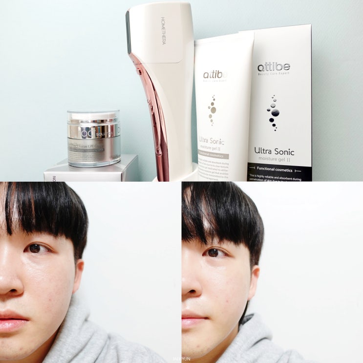  갈바닉마사지기 피부탄력 뷰티디바이스 홈쎄라 홈케어 하자