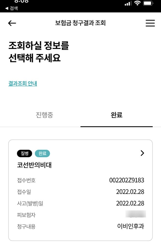 코성형실비처리후기/비염코성형