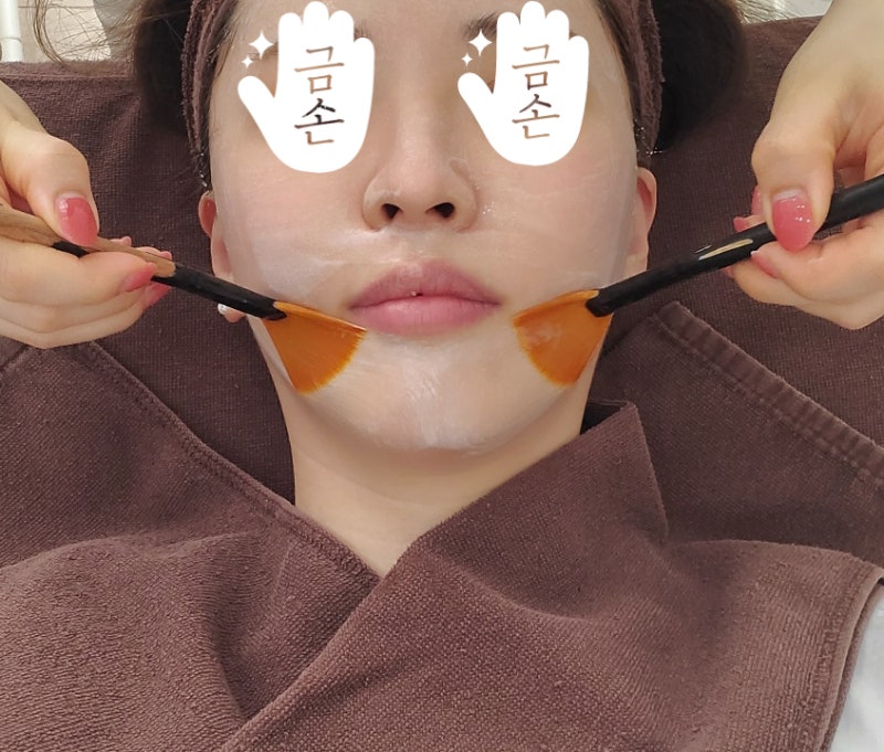 라라필,압출,엘디엠이 관리하는 송파피부과