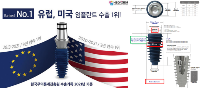 [메가젠임플란트]유럽,미국 수출1위!AnyRidge,AnyOne부터 메가젠임플란트 주가까지!