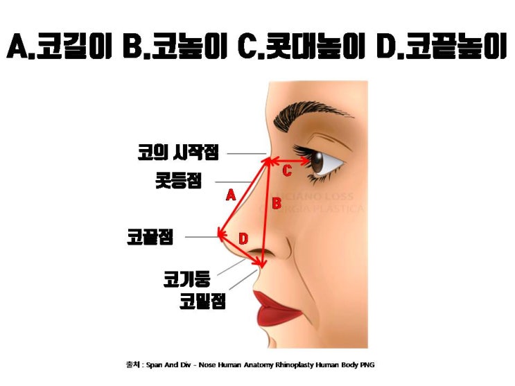  코수술 받기 전 본인 콧대, 코끝, 콧볼 크기 자가진단!!!