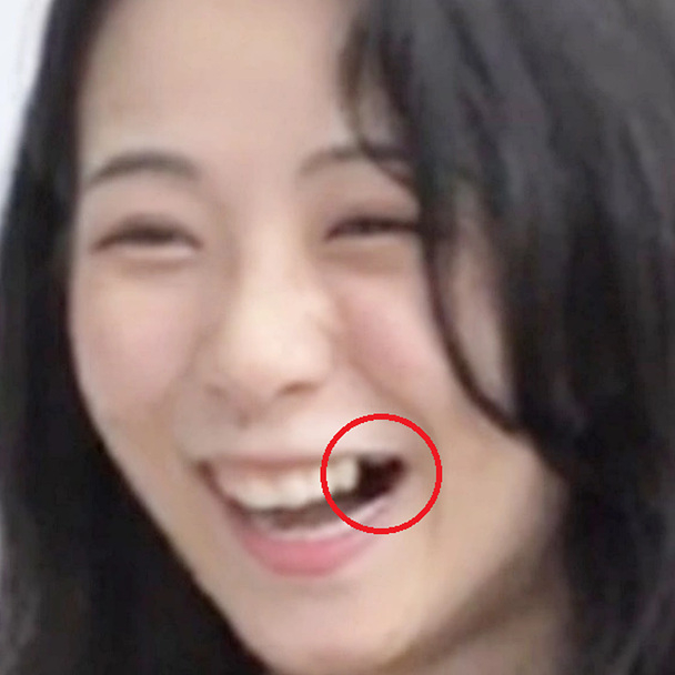 나는 솔로 6기 옥순 이빨 없는 이유 치아 결손 영수 영호 영식 영철 광수 상철 영숙 정숙 순자 영자 현숙 서민갑부 나이 연봉 본명 인스타 학력 프로필
