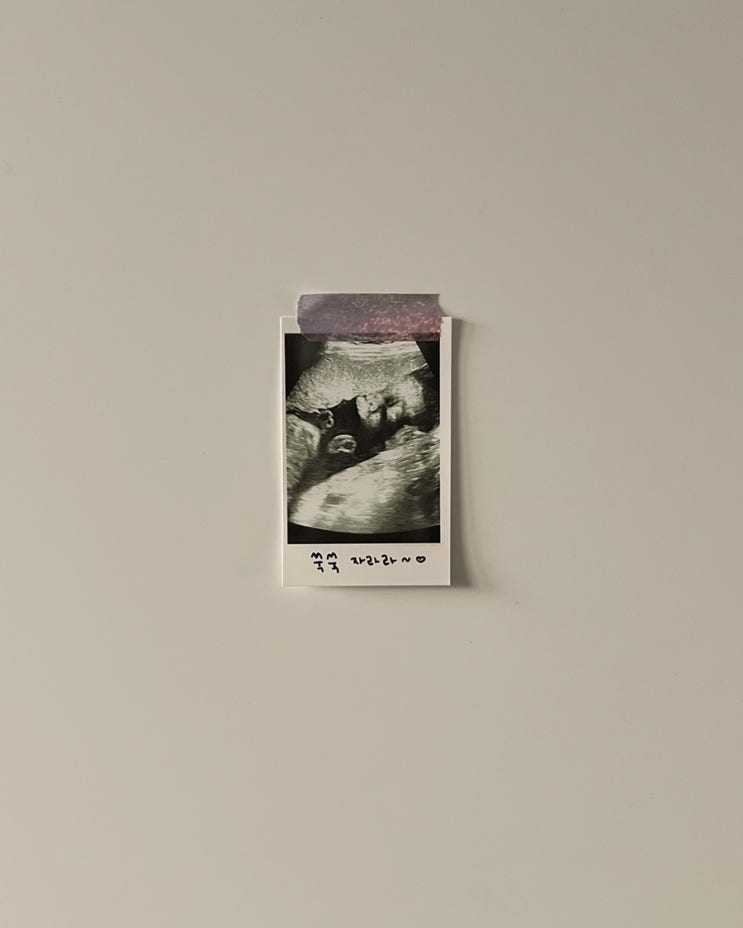  임신 26주, 임당 검사 후기