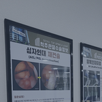  무릎통증원인, 관절내시경으로 진단하고 치료합니다