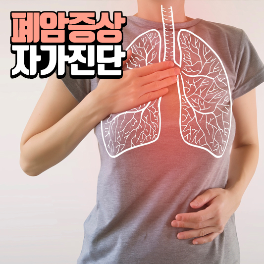  폐암 초기증상, 핑거클러빙 자가진단법 확인해보기