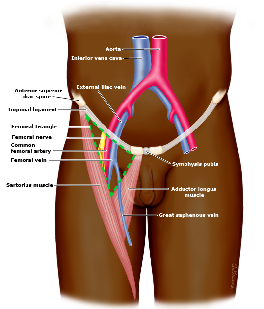 femoral vein catheterization : 대퇴정맥에서 중심정맥관 잡기.
