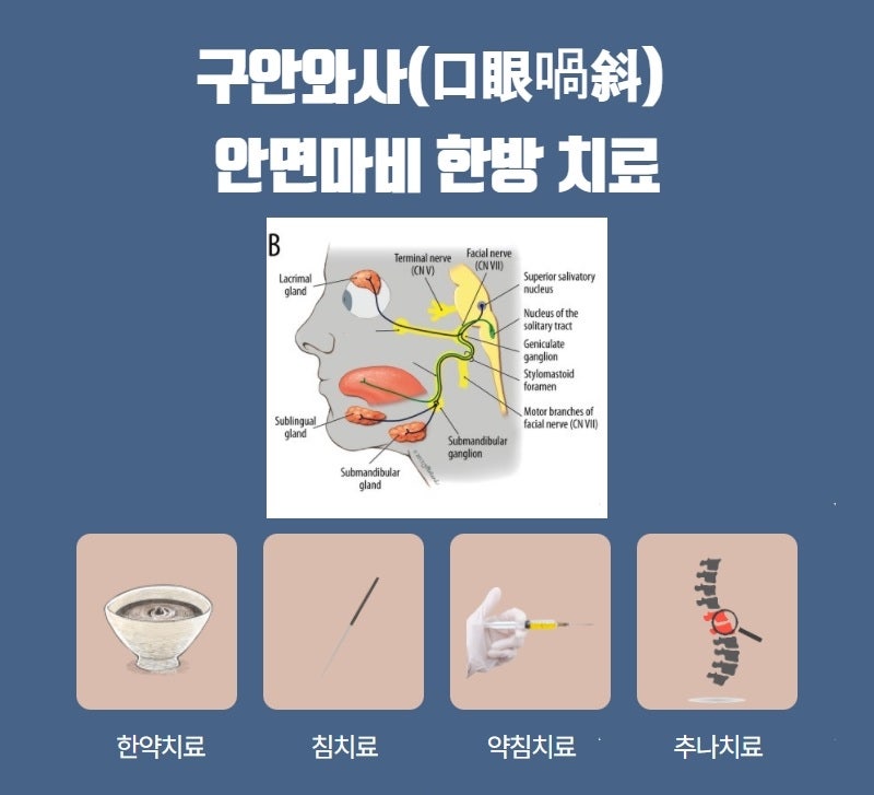 부산 안면마비 구안와사 한의원 빨리 치료 받으세요 부산 연산당당한방병원