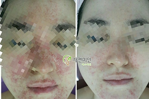 자연미인에스테틱 이미지