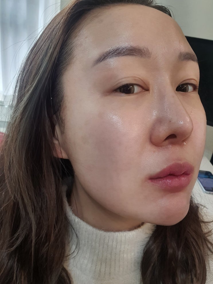  구리피부관리 에스테틱진 - 연어앰플 MTS 하고옴!