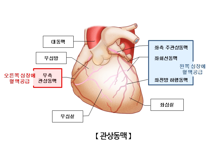 [관상동맥]관상동맥(Coronary artery)의 기능, 질환 그리고 식단