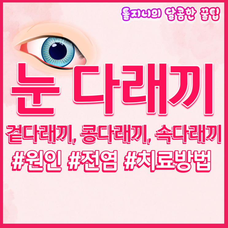  눈 다래끼 원인 전염 및 빨리 낫는 치료 약 : 겉다래끼, 콩다래끼, 속다래끼 차이