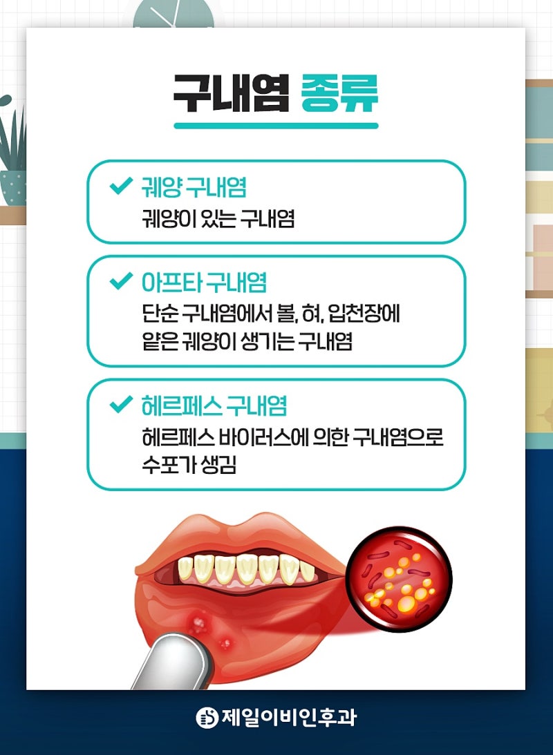 청담이비인후과 구내염 남다르게 2