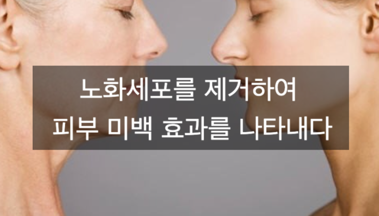  노화세포 제거에 의한 피부 미백 효과