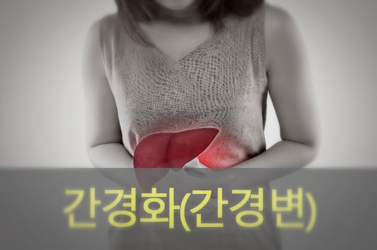  간경화( 간경변) 원인과 증상, 예방, 좋은 음식