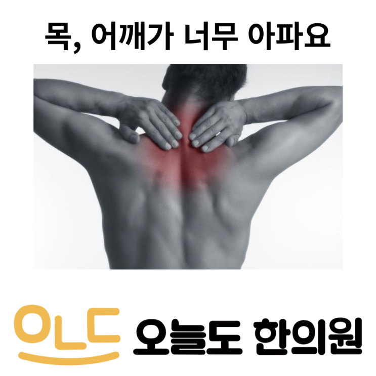  [오늘도한의원] 목, 어깨가 너무 아파요