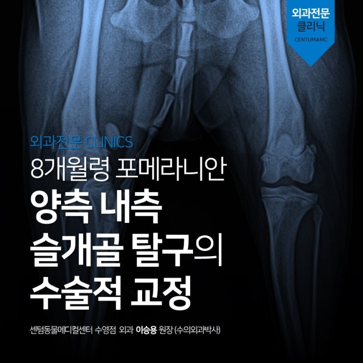  8개월령 포메라니안 양측 내측 슬개골 탈구의 수술적 교정, Grade 2 (센텀동물메디컬센터 수영점, 외과박사수술)