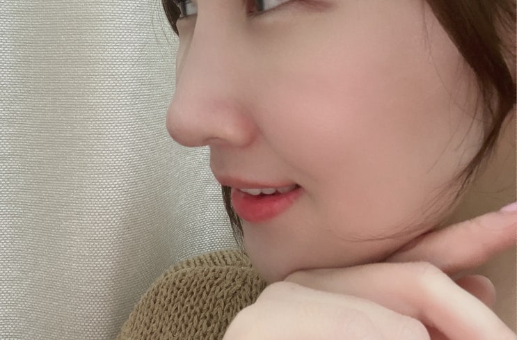  [마블코후기] 코필러후기,콧대필러 (부작용,통증,효과)