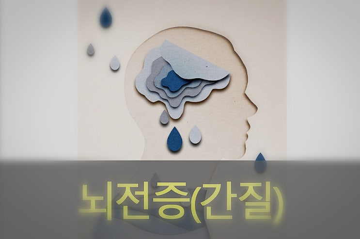  뇌전증( 간질) 원인과 증상, 예방, 좋은 음식