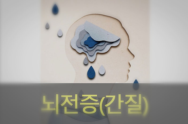 뇌전증( 간질) 원인과 증상, 예방, 좋은 음식 : 네이버 블로그 뇌전증( 간질) 원인과 증상, 예방, 좋은 음식 : 네이버 블로그