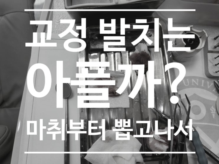 교정 발치는 아픈 것인가? 작은 어금니, 소구치 발치 과정 교정 발치는 아픈 것인가? 작은 어금니, 소구치 발치 과정