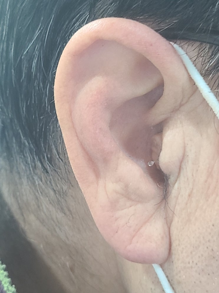  고양시 정부지원보청기 귓속형보청기 수리 [덕양구보청기, 화정보청기, 일산보청기, 파주보청기]