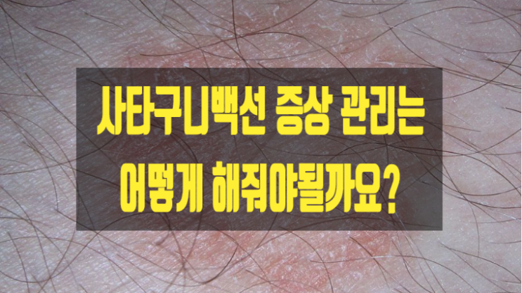  사타구니백선 증상 관리는 어떻게 해줘야될까요?