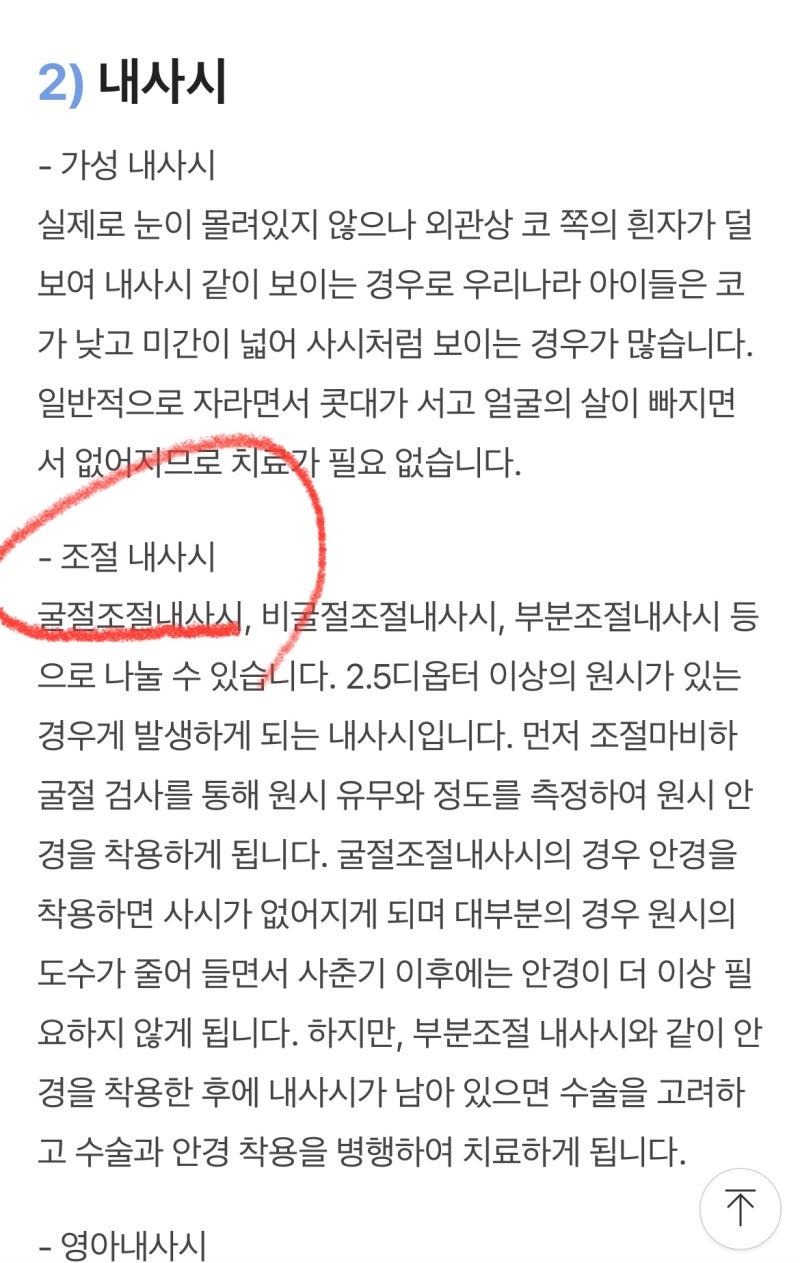 라섹 수술 후 생긴 내사위 복시.. / 시력교정술 뒤 유발된 내편위 원인 / 라식 후 내사시 : 네이버 블로그 라섹 수술 후 생긴 내사위 복시.. / 시력교정술 뒤 유발된 내편위 원인 / 라식 후 내사시 : 네이버 블로그