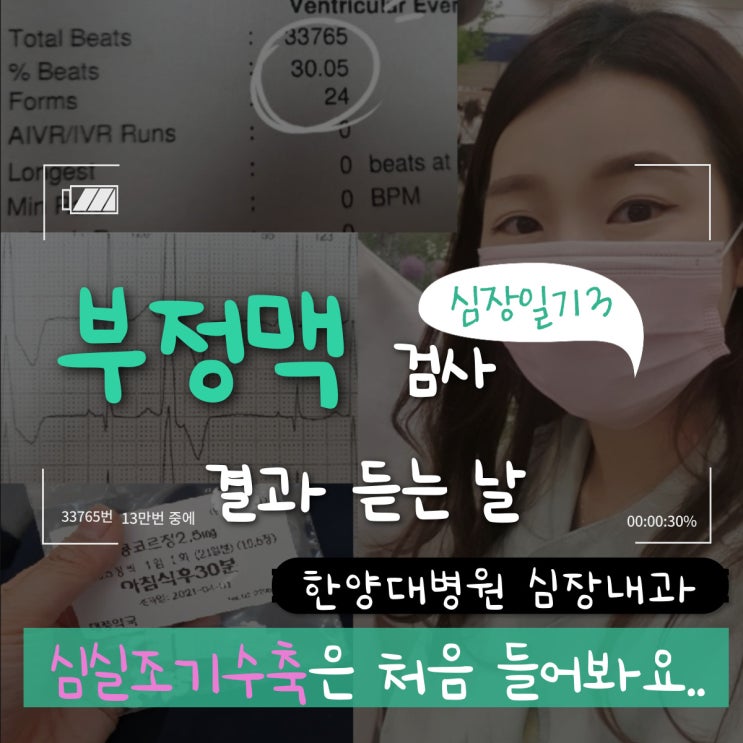  부정맥 일기 3 ) 운동부하검사, 심실조기수축 30% 라구요?