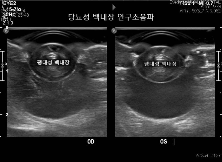  강아지 당뇨성 합병증 전남 백내장 수술 동물병원