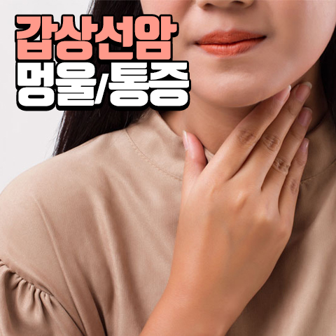 목 통증 멍울 : 갑상선암 증상 알아보기