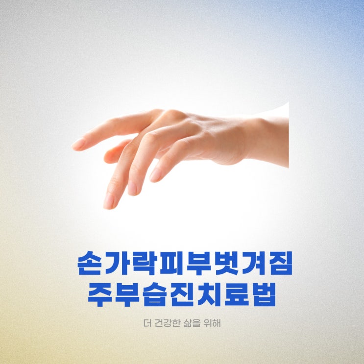  손가락 피부 벗겨짐, 주부습진 치료법