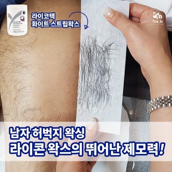 더제이비 / 대구왁스탈모샵 /여름탈모 / 팔다리겨드랑이