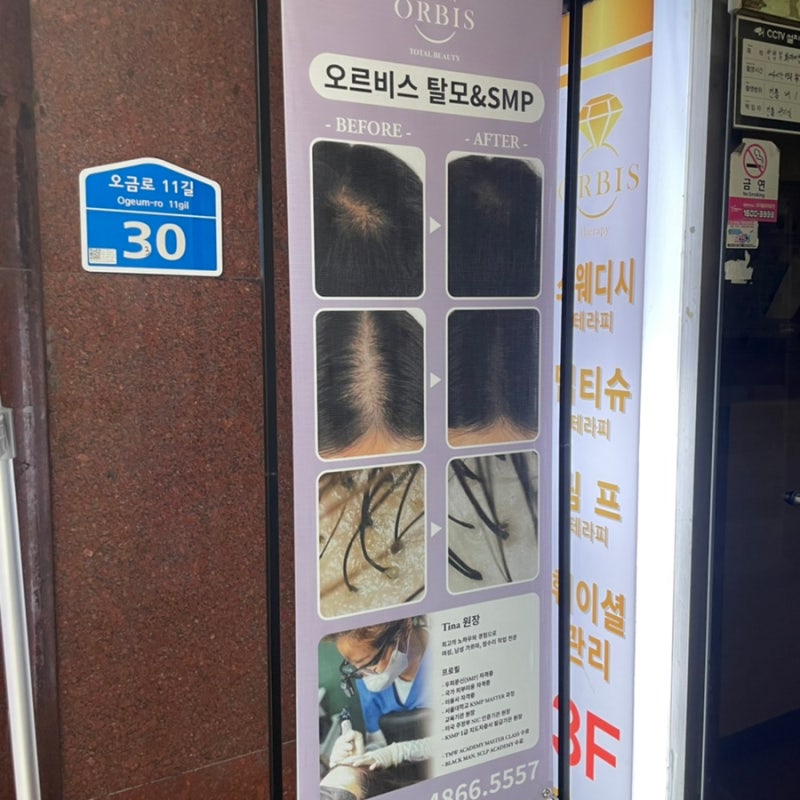 잠실탈모관리 : 이어테라피 잘하는 3