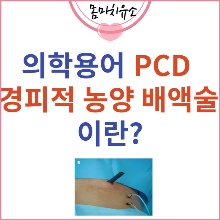 의학용어 PCD 경피적 농양 배액술이란?