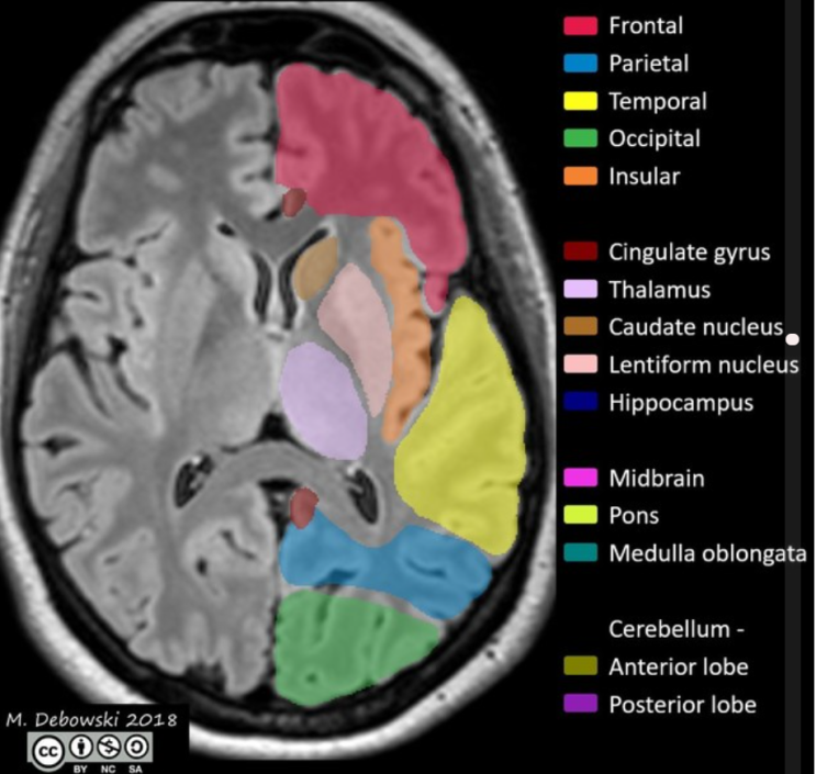 brain MRI anatomy