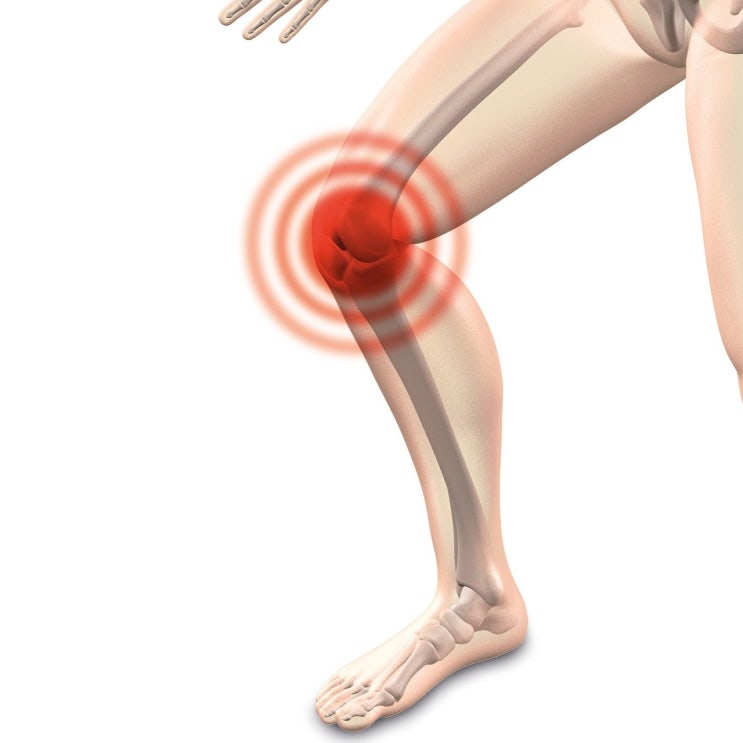 [길벗 칼럼] 퇴행성무릎관절염을 이기는 생활습관과 한방치료