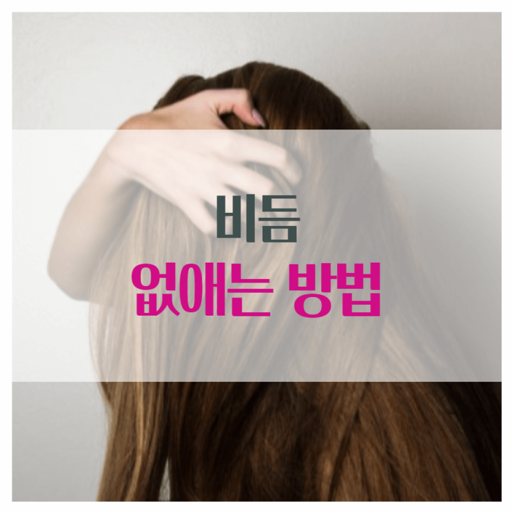  비듬 없애는 방법 자세히 알아보기