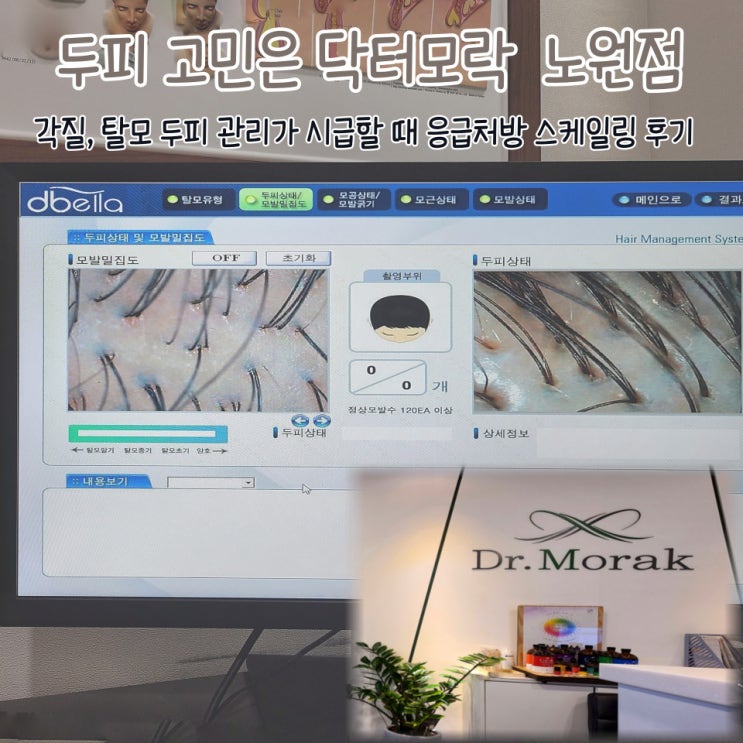  노원 두피탈모: 두피 관리는 닥터모락 스케일링 후기