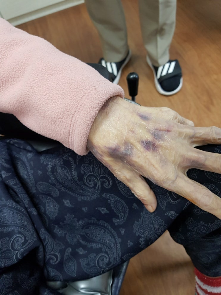  할머니 폭행한 요양보호사 음료수 안 먹는다고 골절 시켜