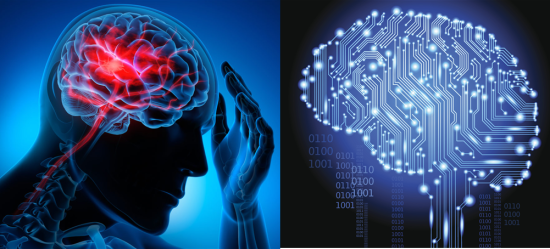  인공지능[21]: Artificial Neural network(인공신경망), Brain Computer Interfaces(BCI, 뇌와 컴퓨터의 접속), Serial Processing and Parallel Processing(직렬처리와 병렬처리)
