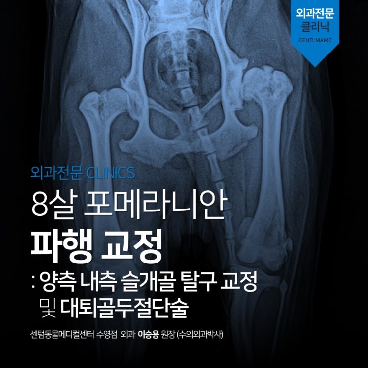  8살 포메라니안 파행 교정 <양측 내측 슬개골 탈구 교정> 및 <대퇴골두절단술> (센텀동물메디컬센터 수영점 정형외과 수술 전문 동물병원)